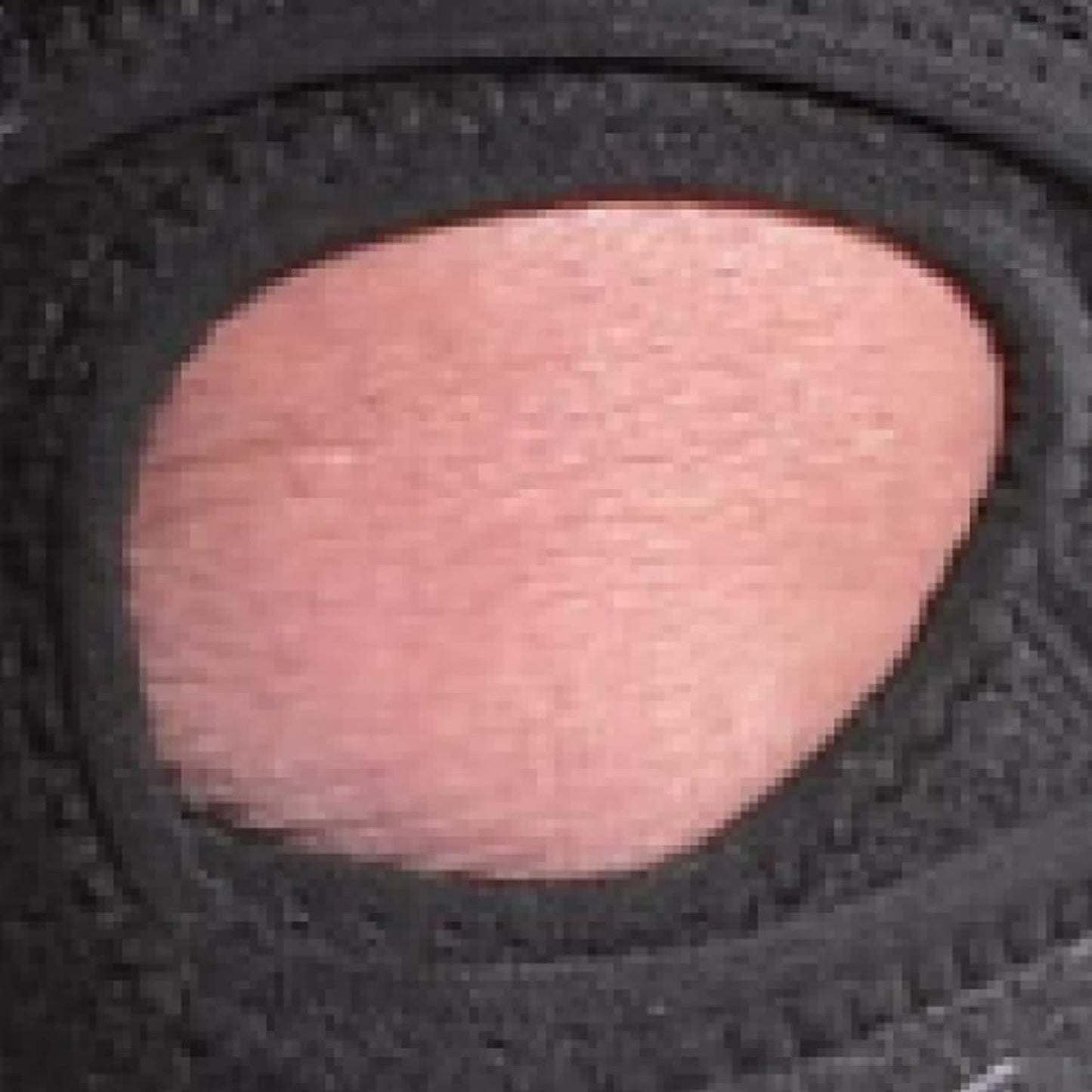 EXTREME PATELLA TENDON